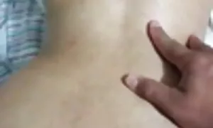 ken anal prolapse kw ...