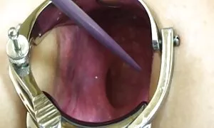 m ngu a mciem iyol s ...