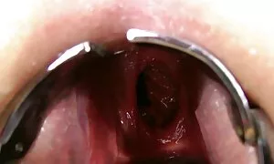 fisting anal kwa har ...