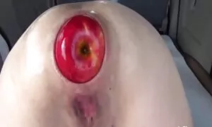 anal fisting u eren  ...