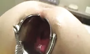 anal, mbayevkasev mb ...