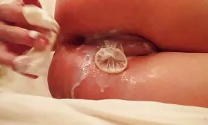 anal u a lu a sperm  ...